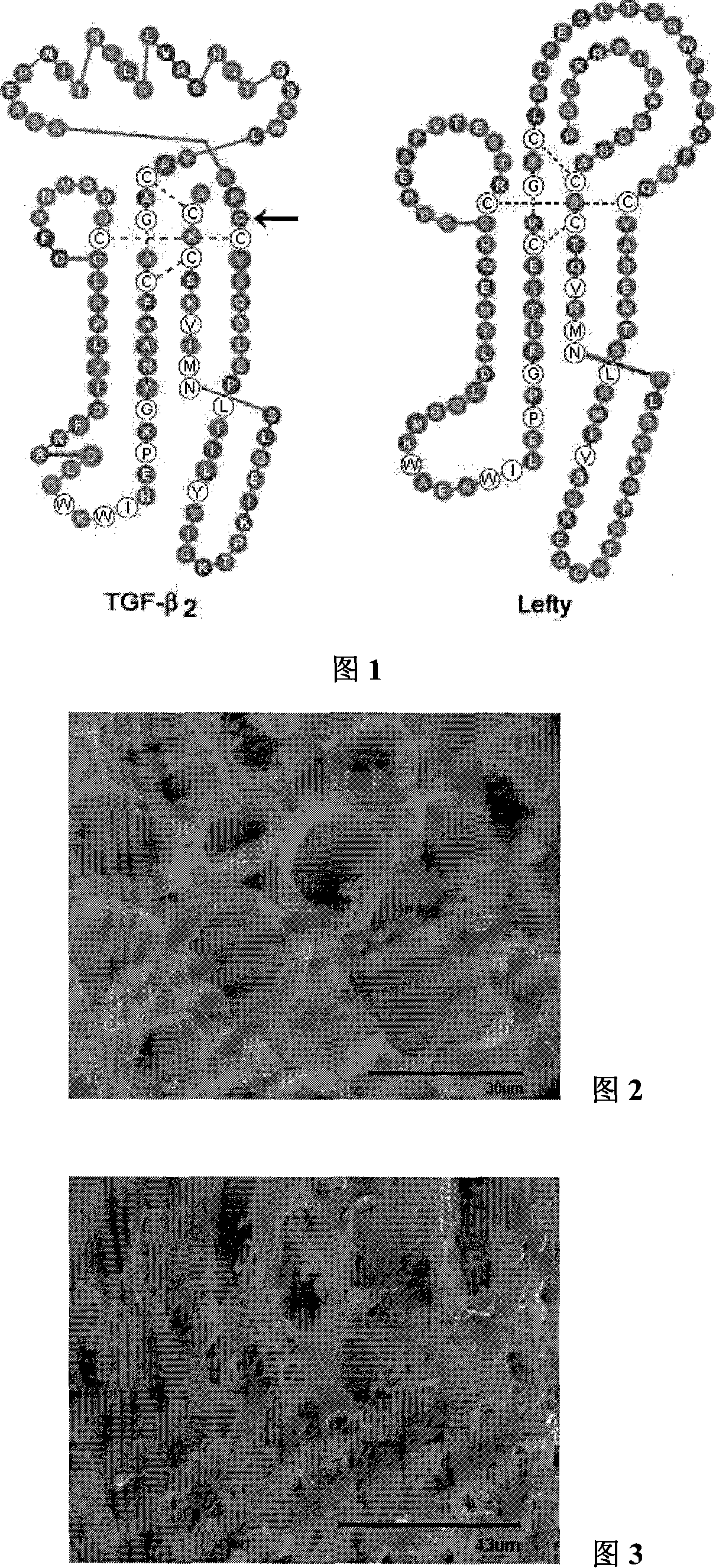 Application of Lefty protein in restraining fibrosis lesion of organ