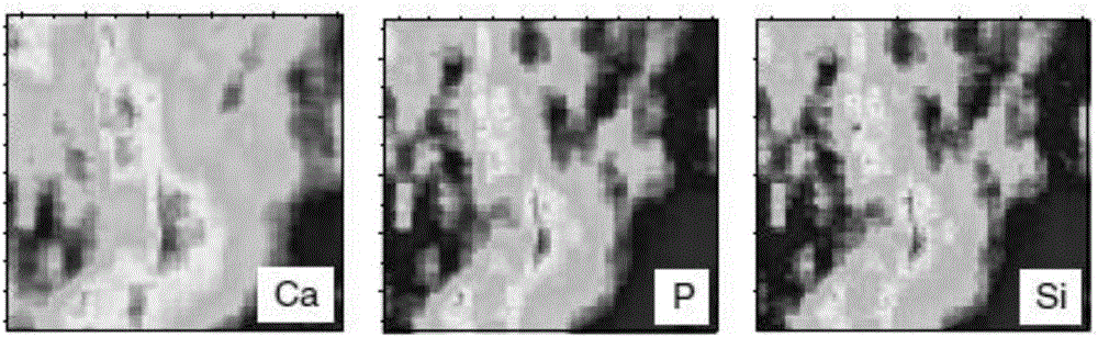 Regenerative medical material and preparation method and application thereof