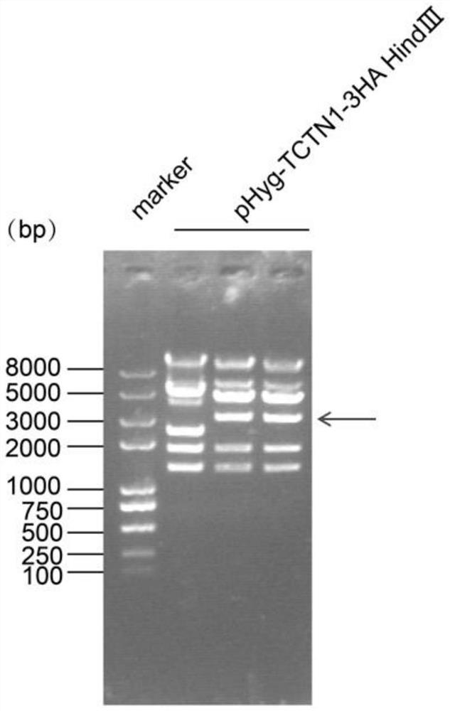 Chlamydomonas reinhardtii TCTN1 expression plasmid as well as construction method and application thereof