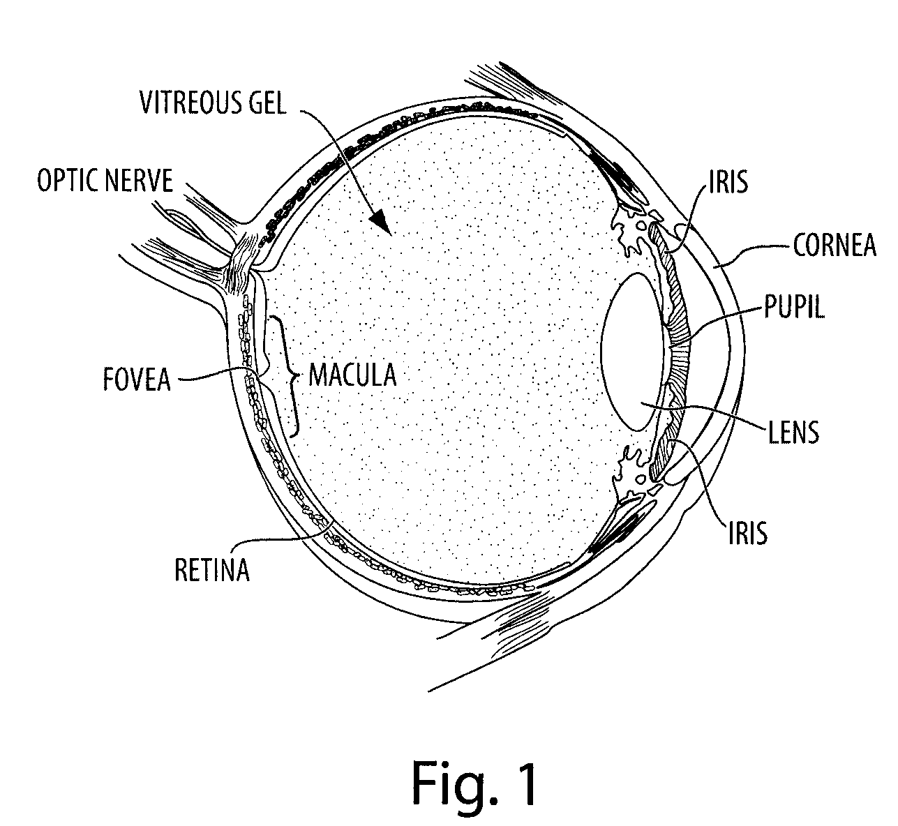 Apparatus and method for augmenting sight