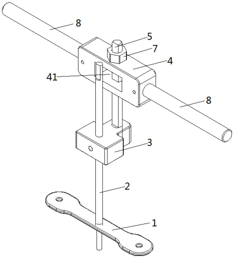 External fixing frame