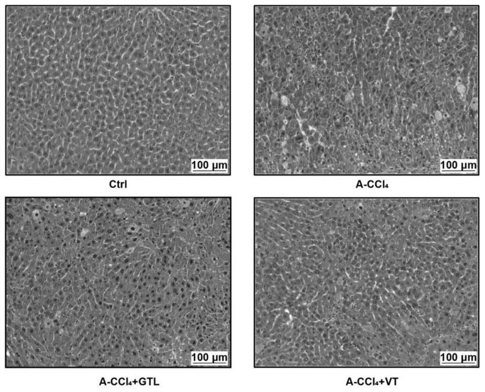 Application of ampelopsis grossedentata water extract in preparation of preparation for improving liver injury