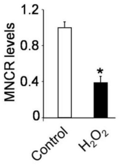 The role of circRNA MNCR in regulating cardiomyocyte necrosis and myocardial ischemia injury