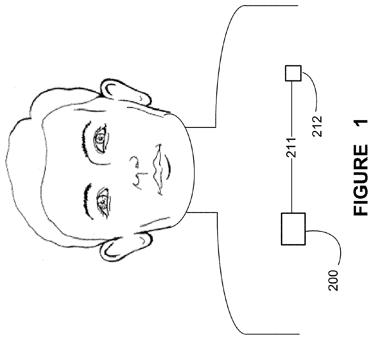 Classifying seizures as epileptic or non-epileptic using extra-cerebral body data