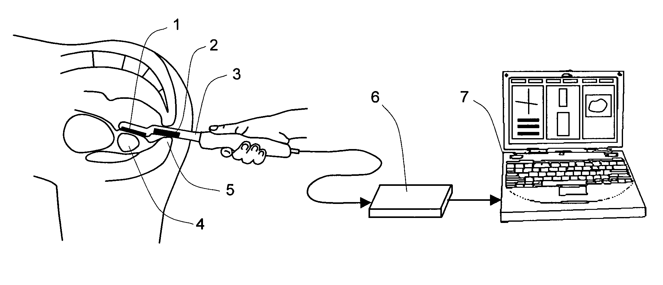 Method and a dual-array transducer probe for real time mechanical imaging of prostate