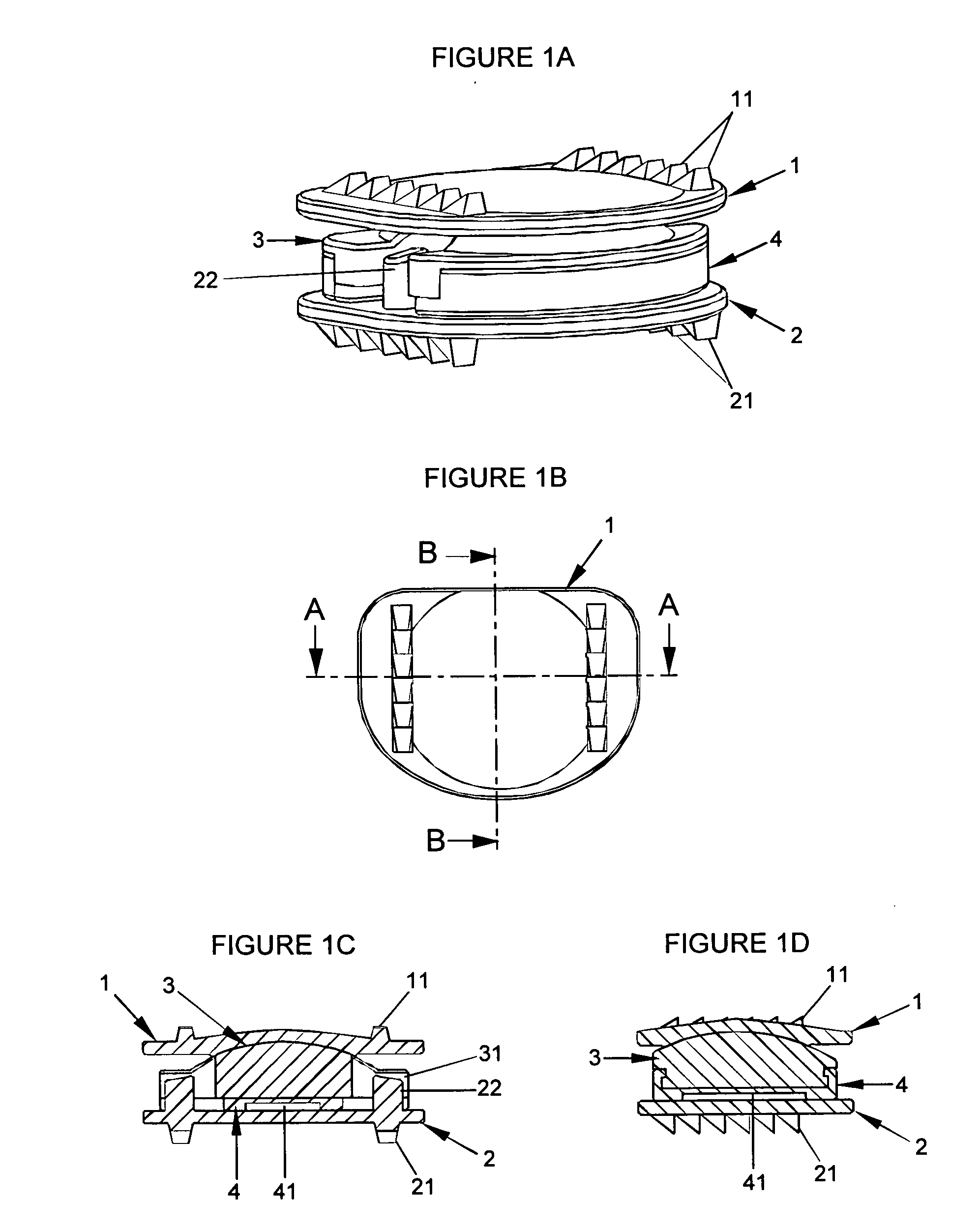 Intervertebral disc prosthesis