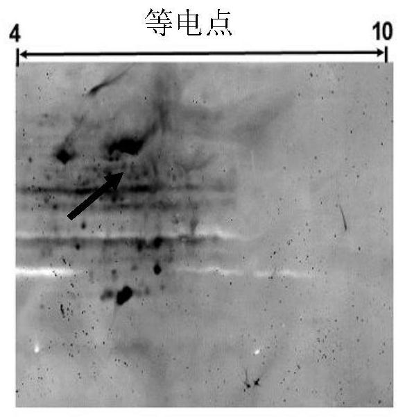 Candidate component of tuberculosis vaccine and vaccine containing the component