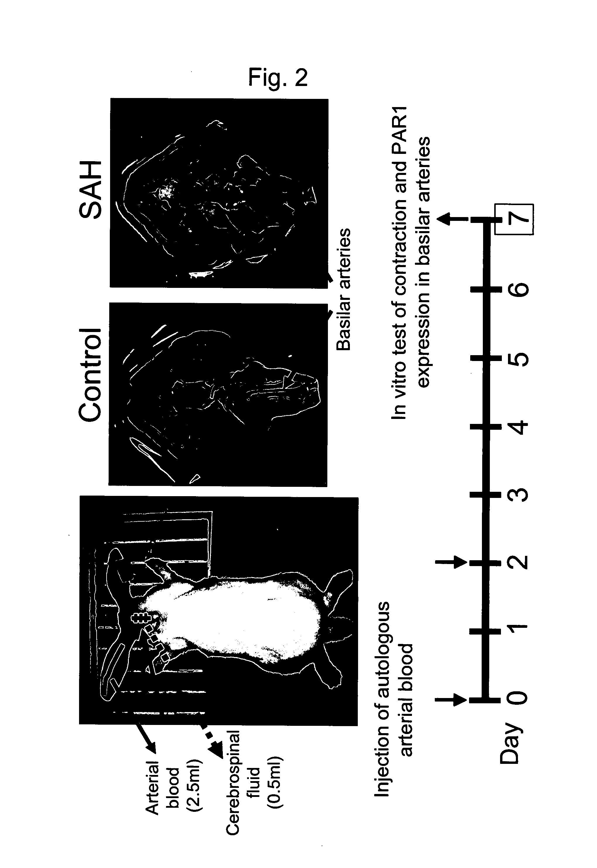 Remedy for Angiospasm Accompanying Subarachnoid Hemorrhage Containing Thrombin Receptor Antagonist as the Active Ingredient