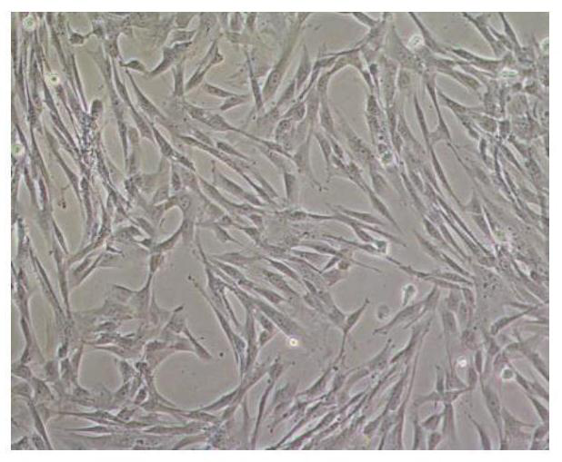 Hernia repair material compounded with adipose-derived mesenchymal stem cells and gelatin sponge as well as preparation method and application of hernia repair material