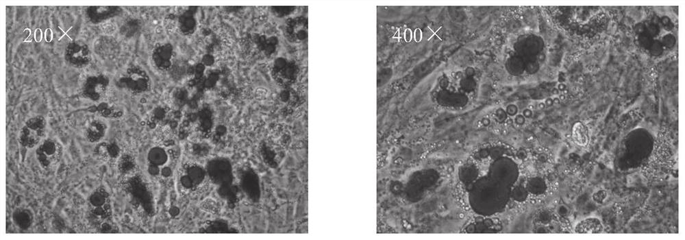 Hernia repair material compounded with adipose-derived mesenchymal stem cells and gelatin sponge as well as preparation method and application of hernia repair material