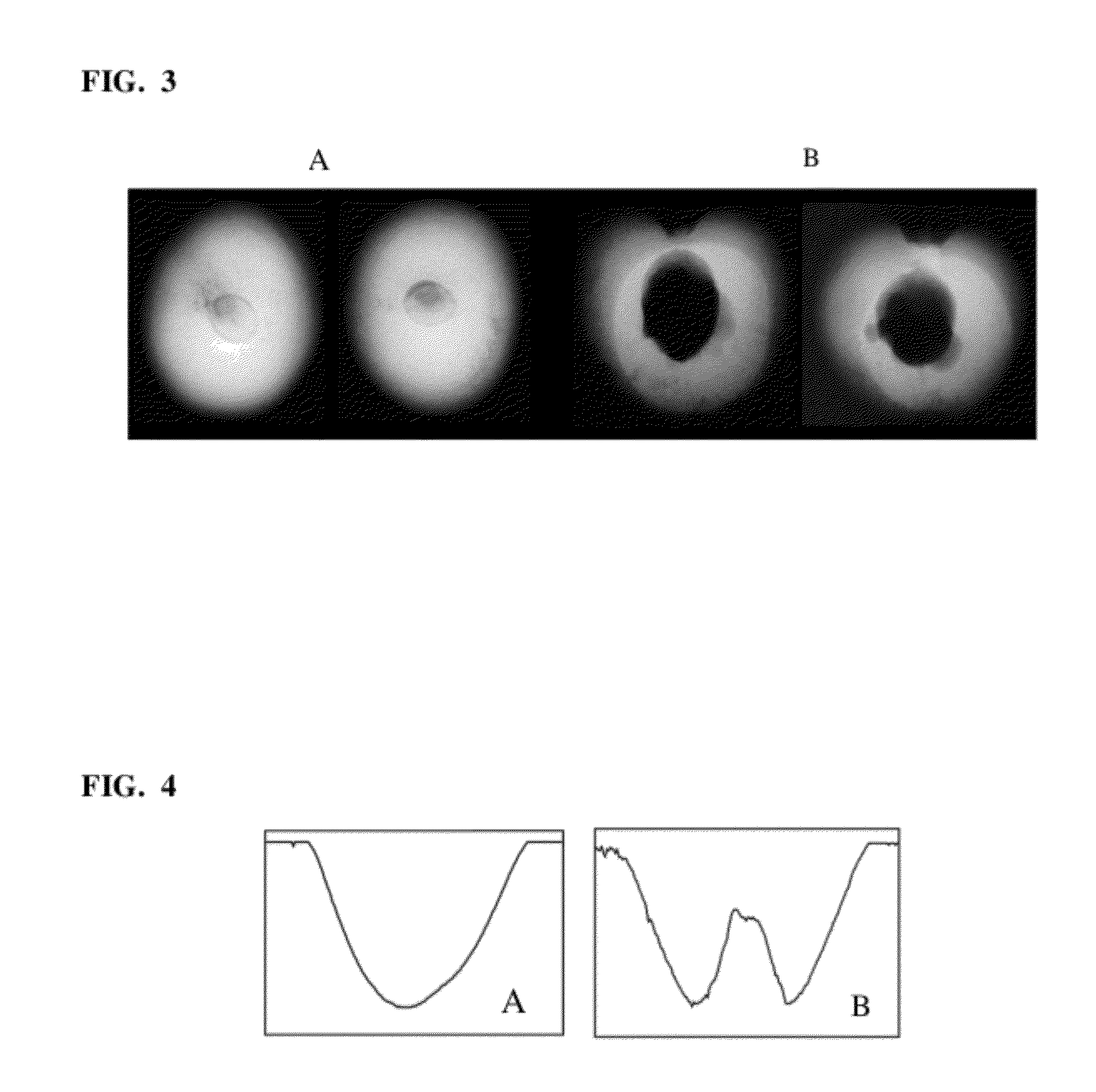 One dimensional linescan X-ray detector