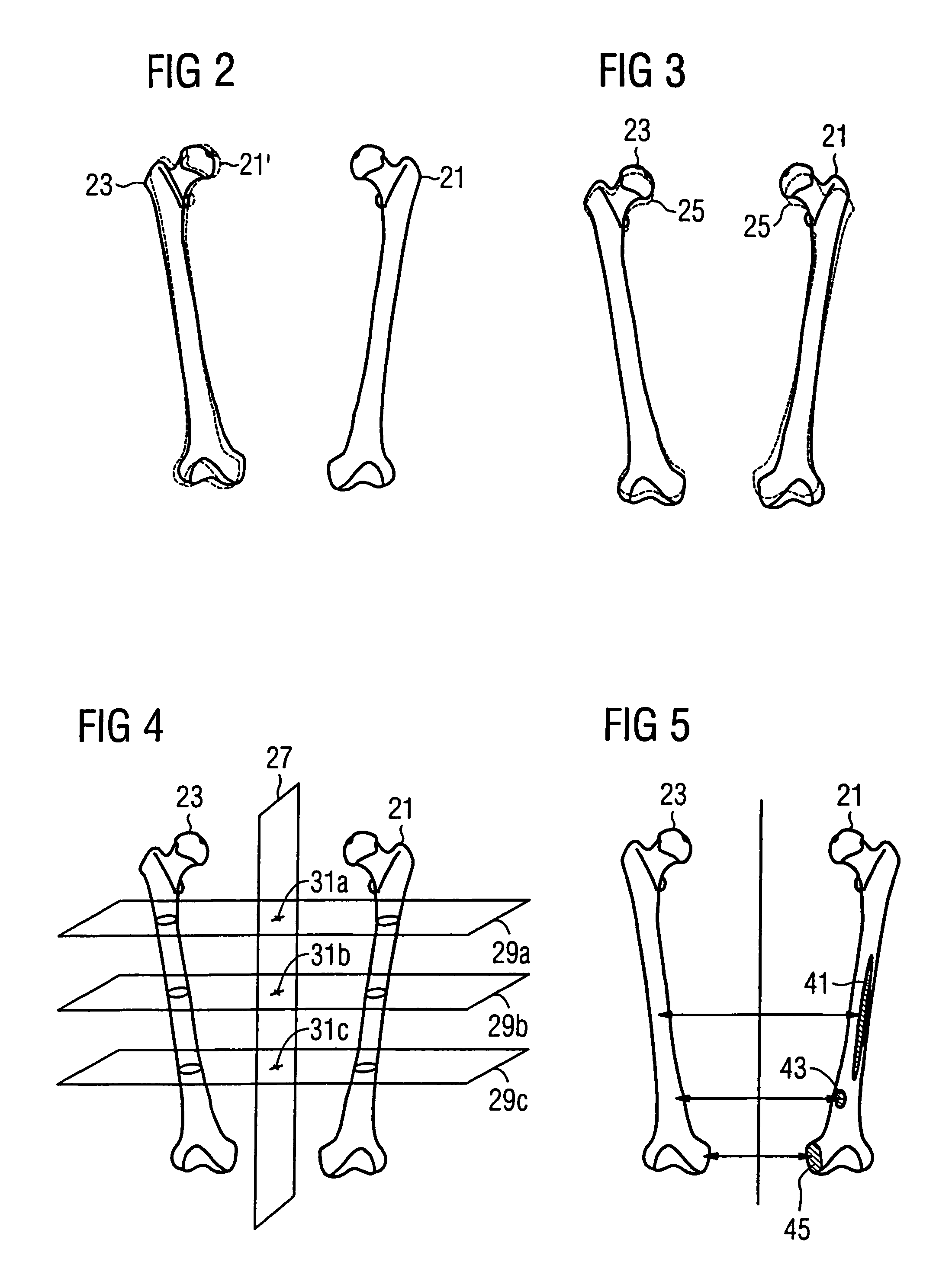 Method and apparatus for evaluating a 3D image of a laterally-symmetric organ system