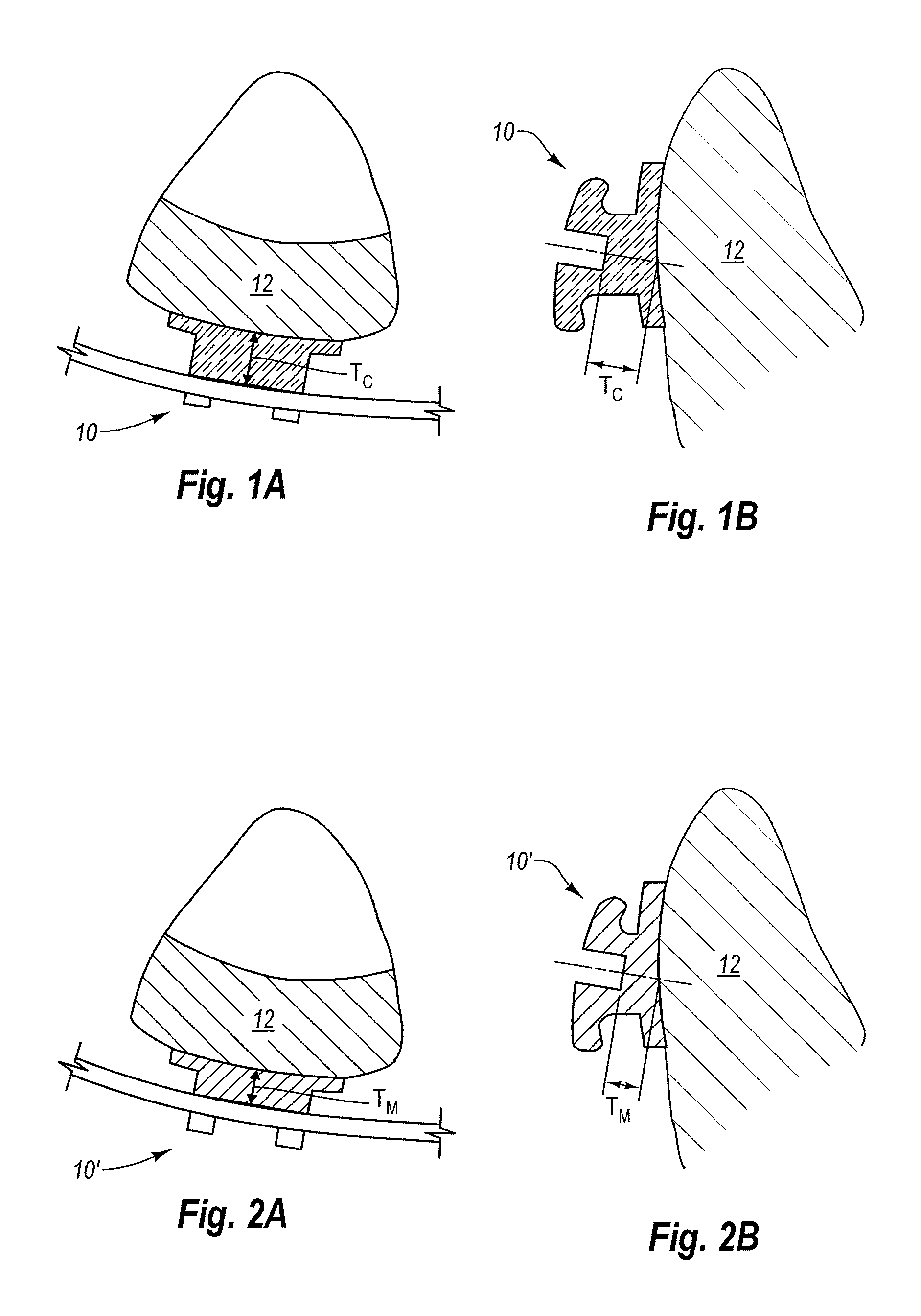 Coordinated metal and ceramic orthodontic bracket systems