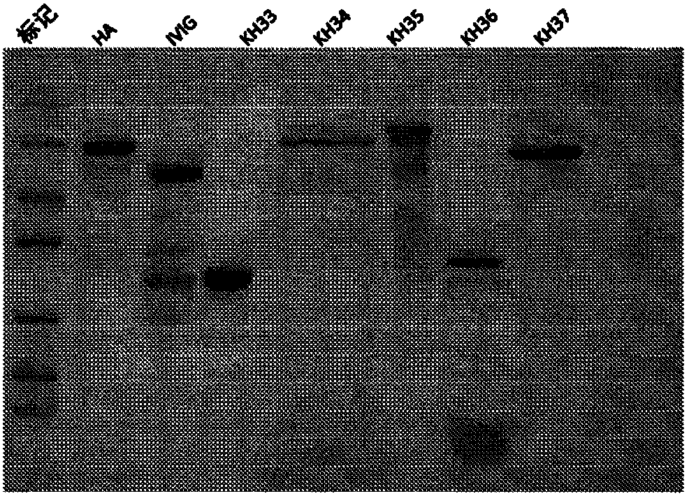 Process of cloning and further purification to make a recombinant intravenous immunoglobulin