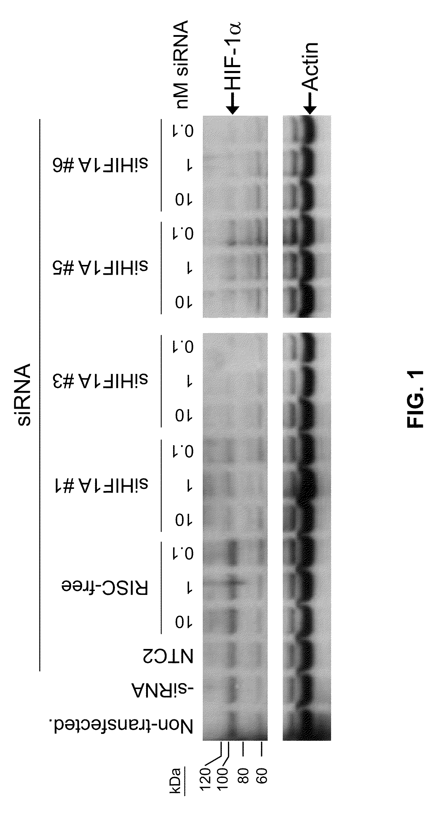 RNAi-MEDIATED INHIBITION OF H1F1A FOR TREATMENT OF OCULAR ANGIOGENESIS