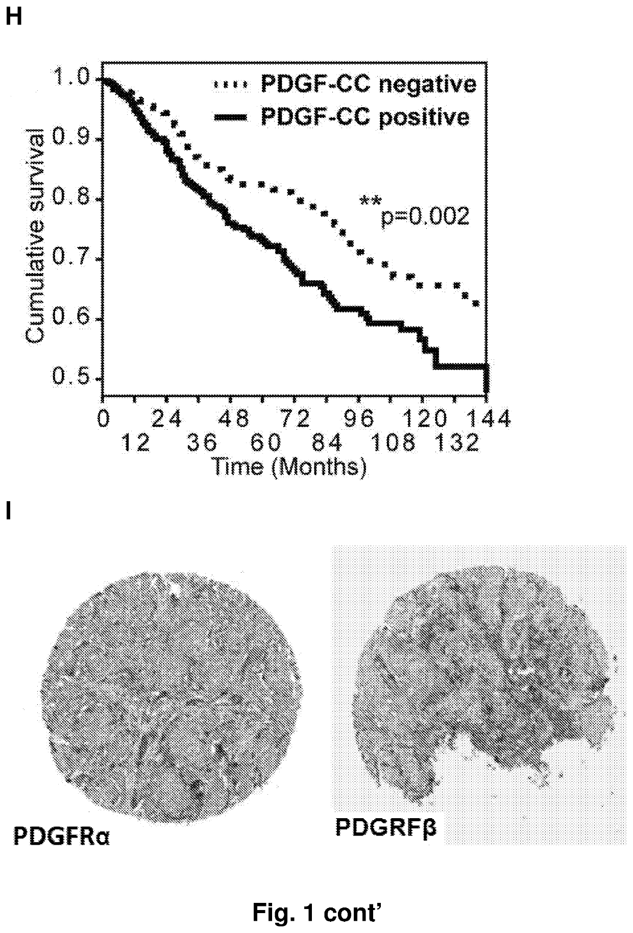 Treatment of er-negative breast cancer with an pdgf-cc inhibitor and Anti-estrogen