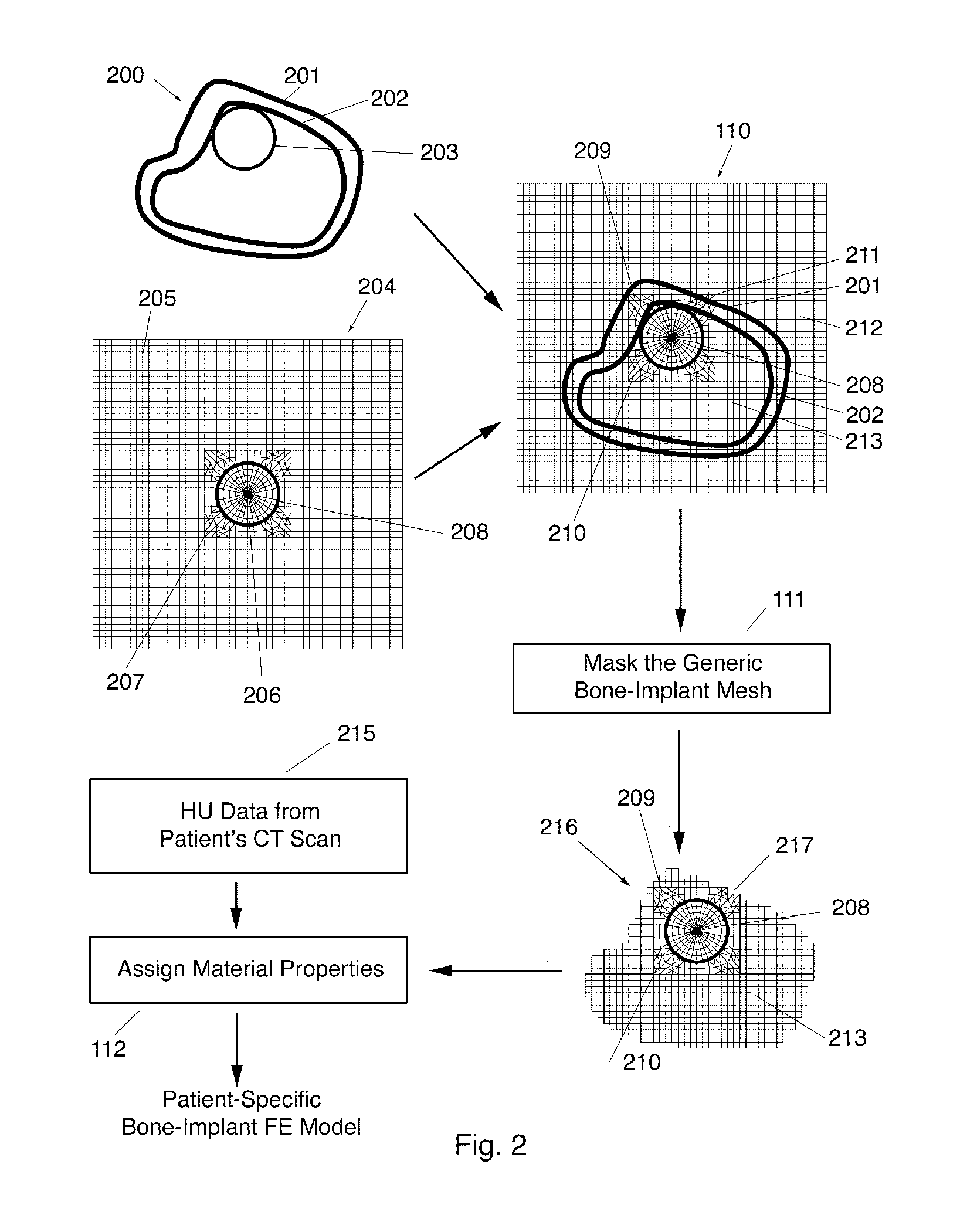 Automated patient-specific bone-implant biomechanical analysis