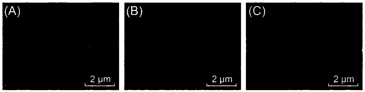 Ultrasonic contrast agent and preparation method and application thereof