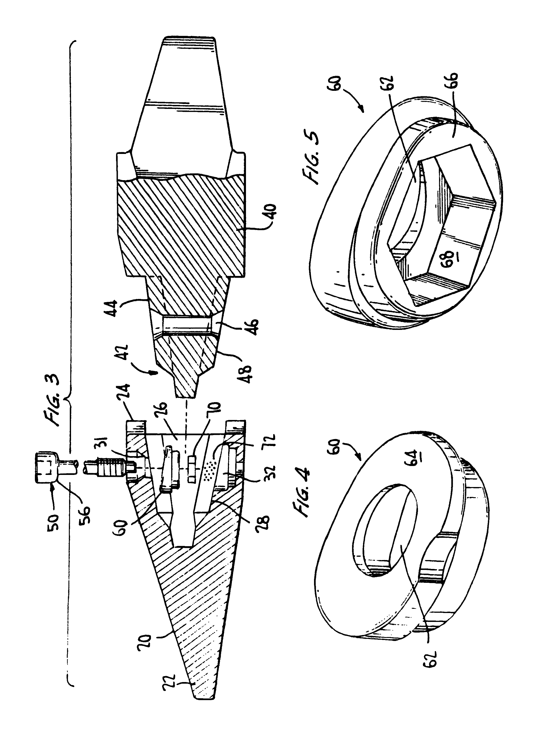 Excavation retention assembly