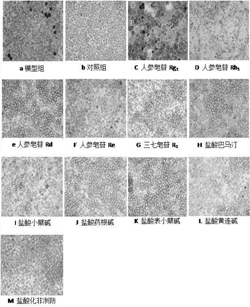 Combined application of ginsenoside and berberine or berberine salt to preparation of drugs for treating atherosclerosis or hyperlipidemia