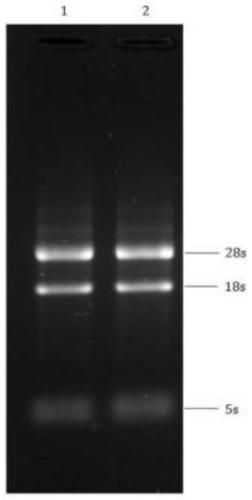 Breast cancer 21 gene detection kit