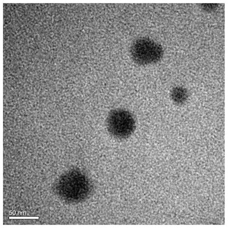 Isolated soybean protein chitosan nano gel and preparation method and application thereof