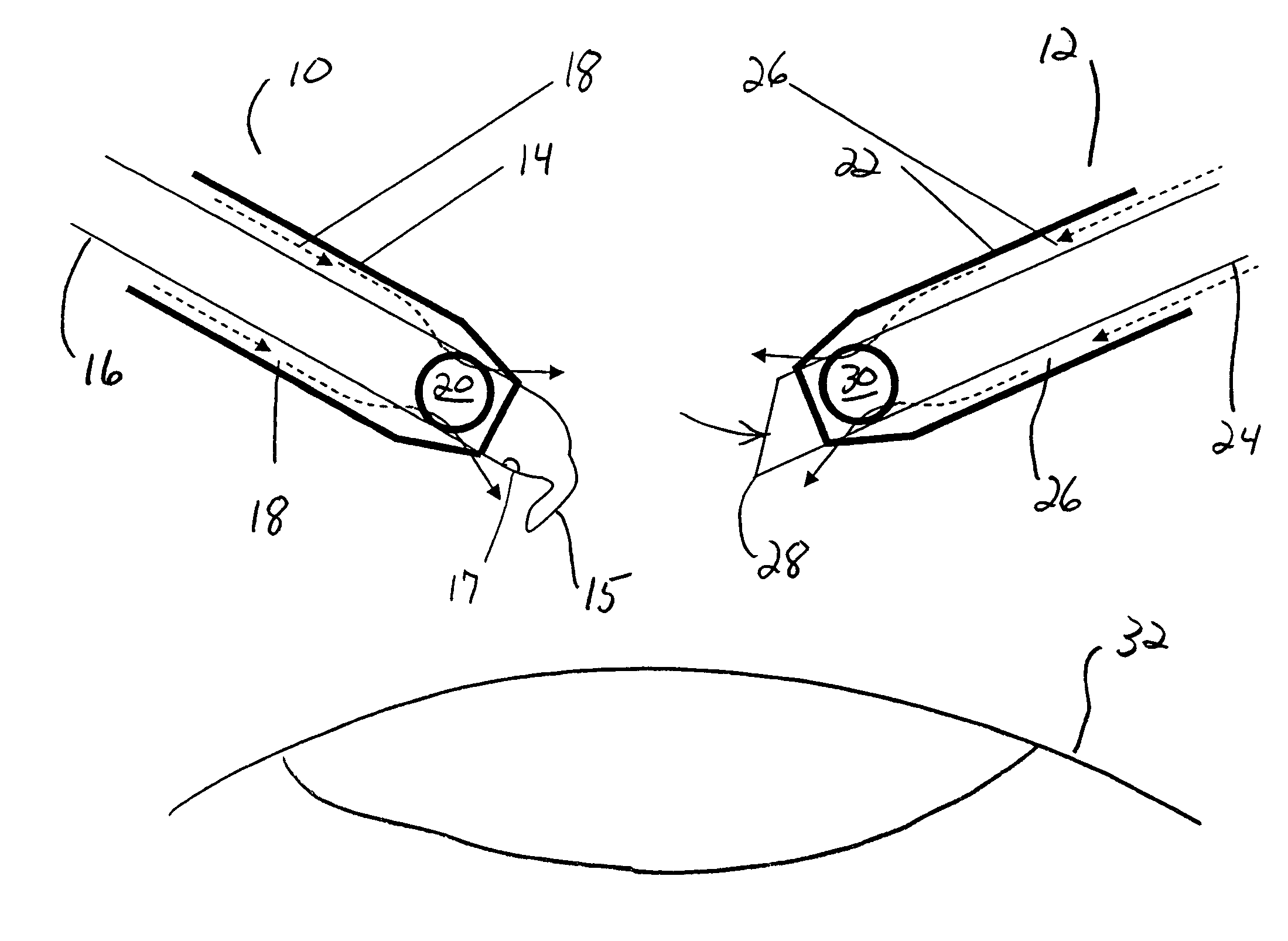 Surgical apparatus