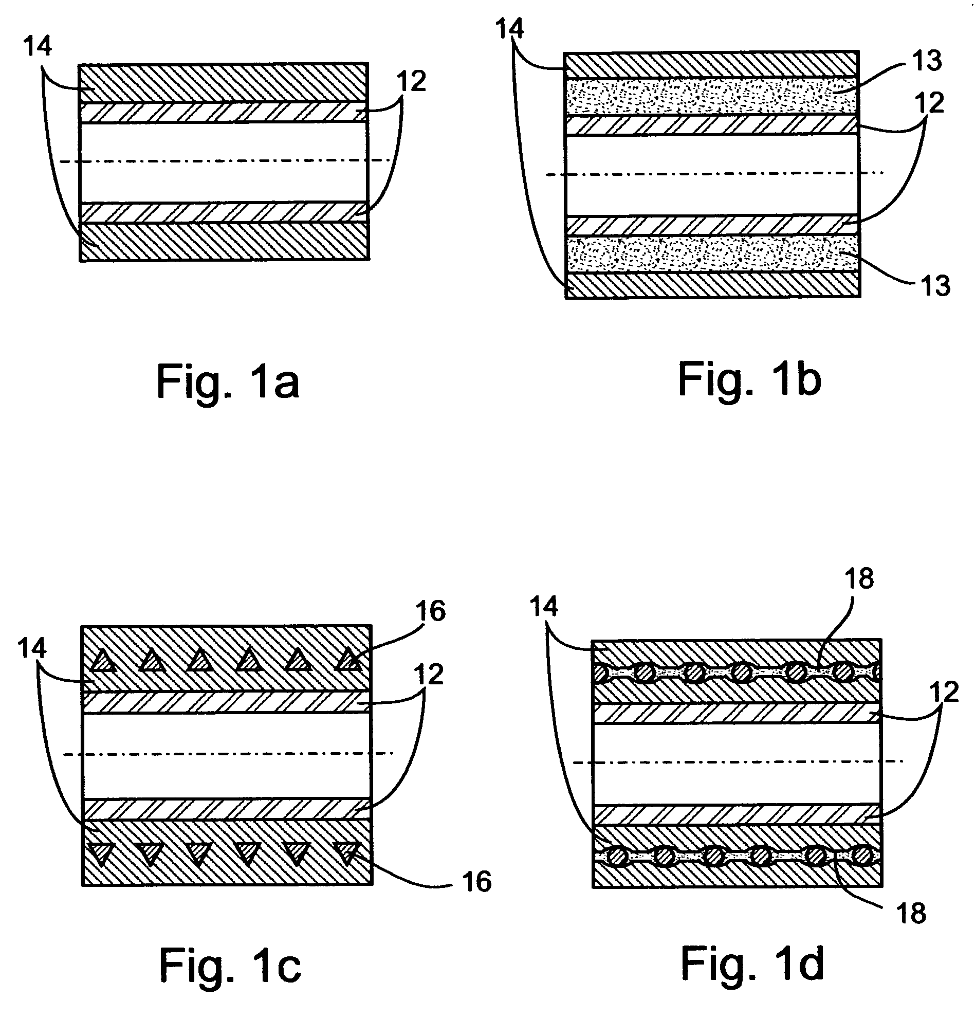 Vascular prosthesis and method for production thereof