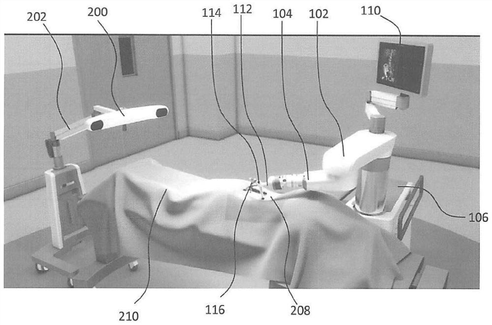 Surgical robot system