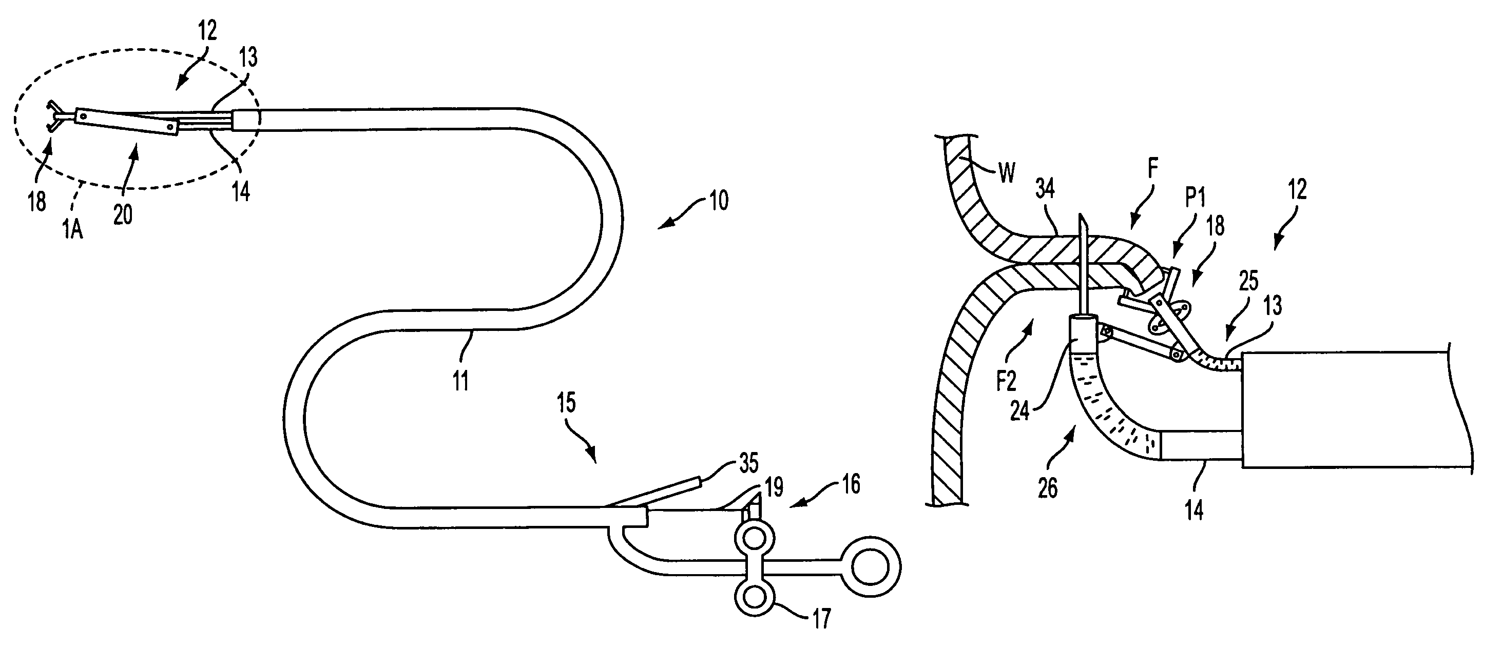 Apparatus and methods for forming gastrointestinal tissue approximations