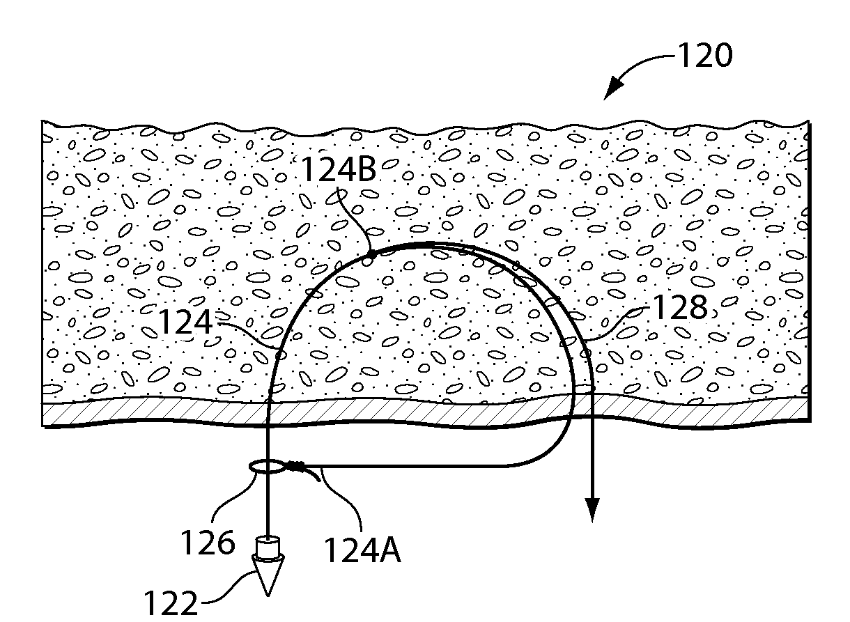 Systems and methods for soft tissue reconstruction