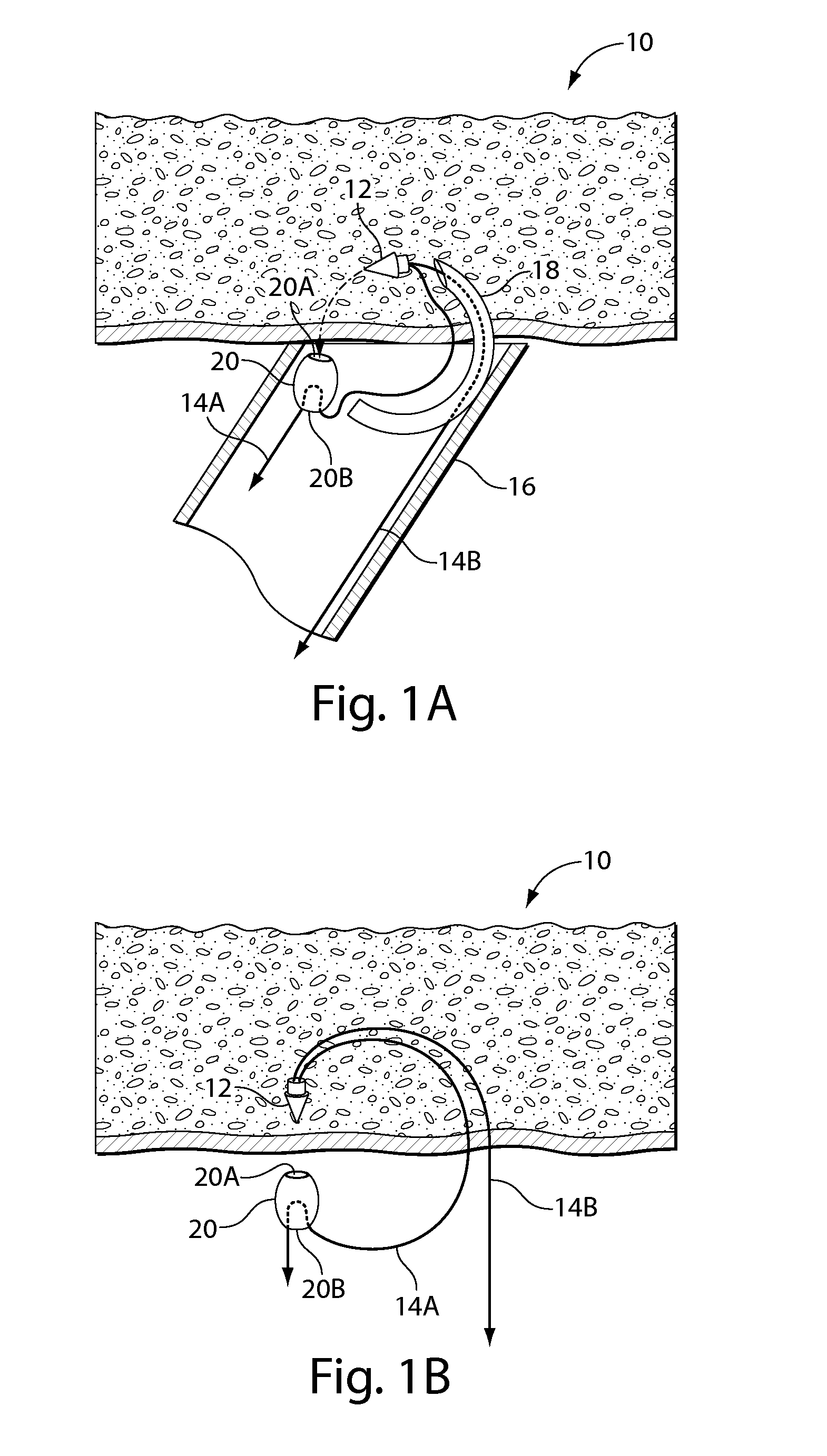 Systems and methods for soft tissue reconstruction