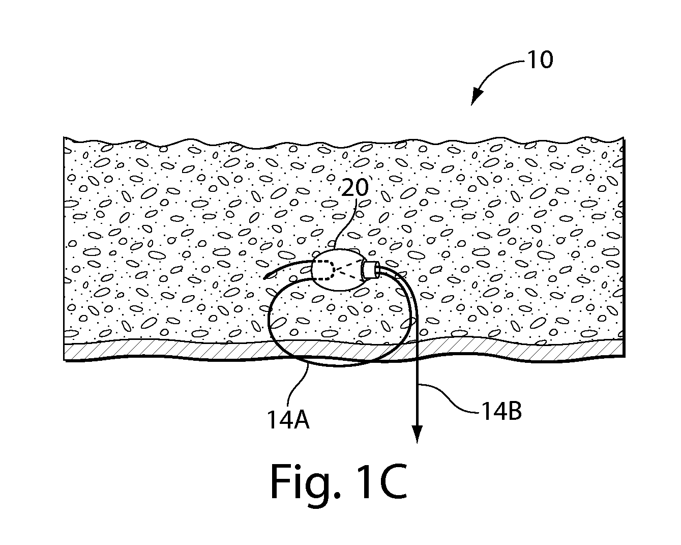 Systems and methods for soft tissue reconstruction