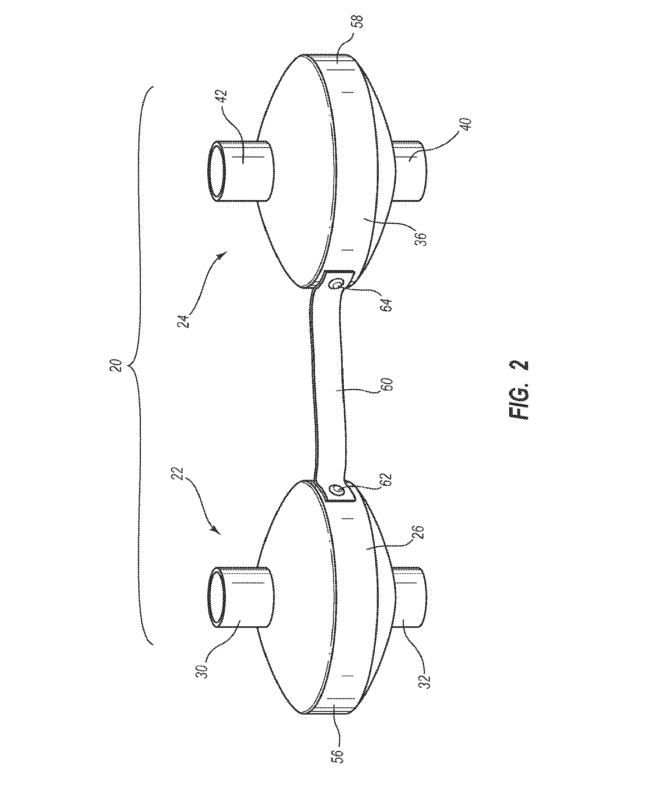 System, Method and Apparatus for Removal of Volatile Anesthetics for Malignant Hyperthermia