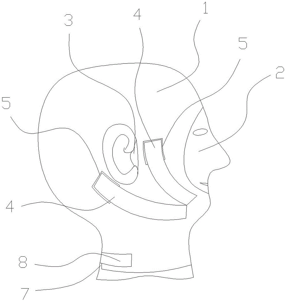 Post operation head maxilla part elastic sleeve for maxillofacial part