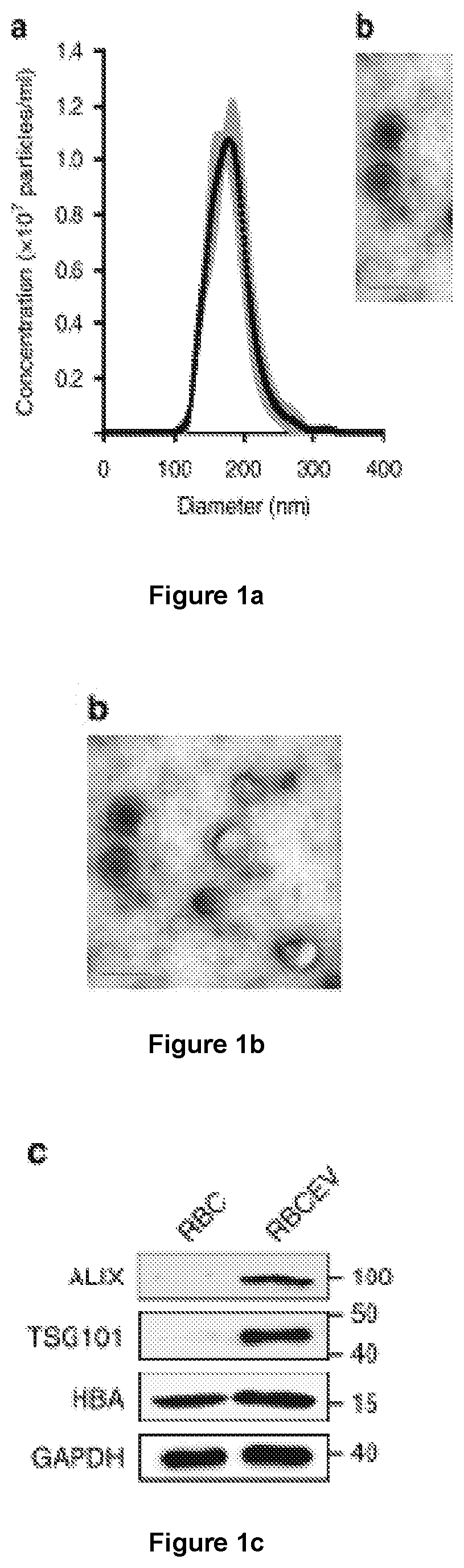 Cargo loaded extracellular vesicles