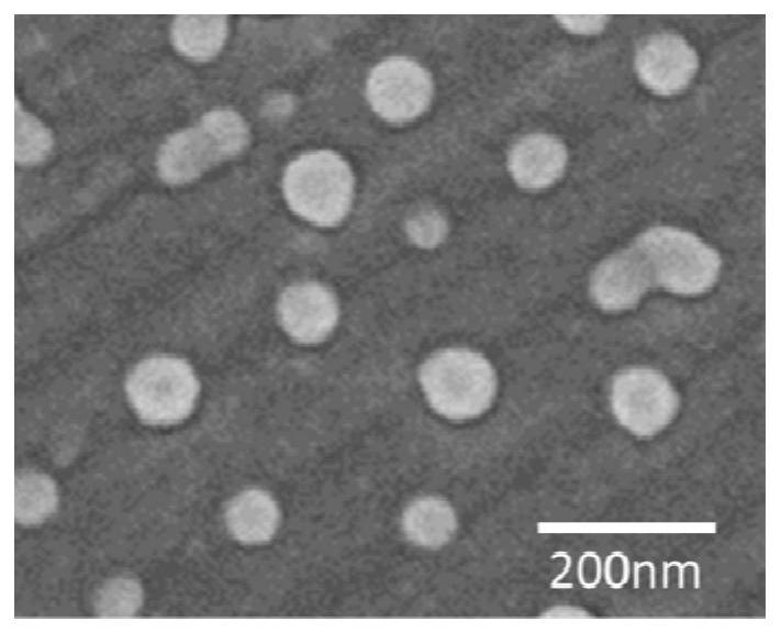 Nano-preparation capable of being locally delivered and used for inhibiting radiofrequency ablation cardiac tissue inflammation and preparation method and application of nano-preparation