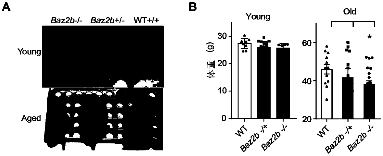 Application of Baz2b gene as target spot in senescence alleviation