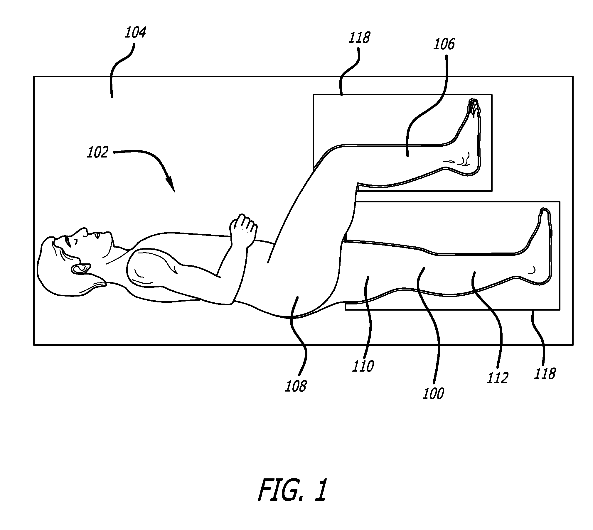 Surgical implantation method and devices for an extra-articular mechanical energy absorbing apparatus