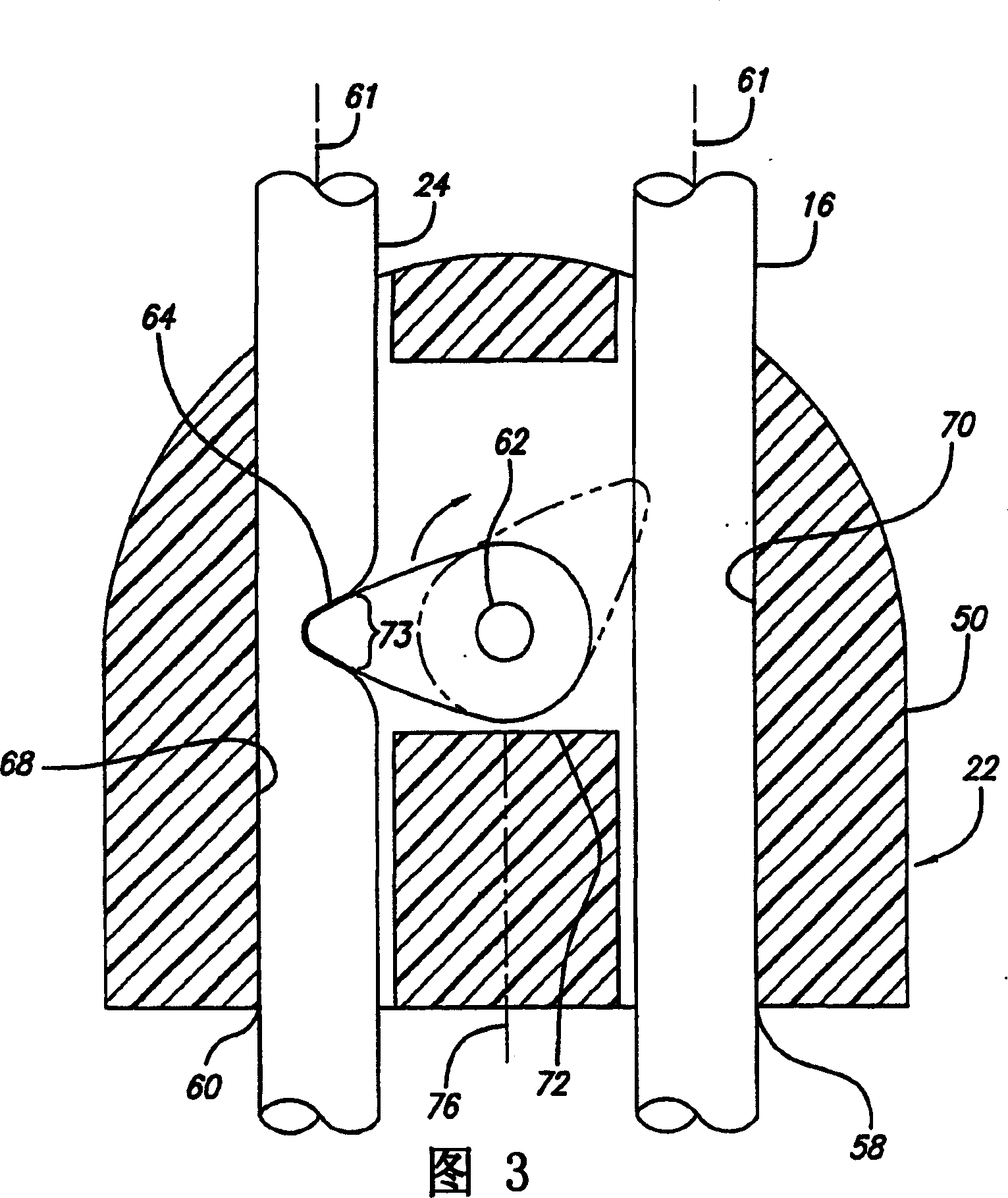 Improved burette safety valve