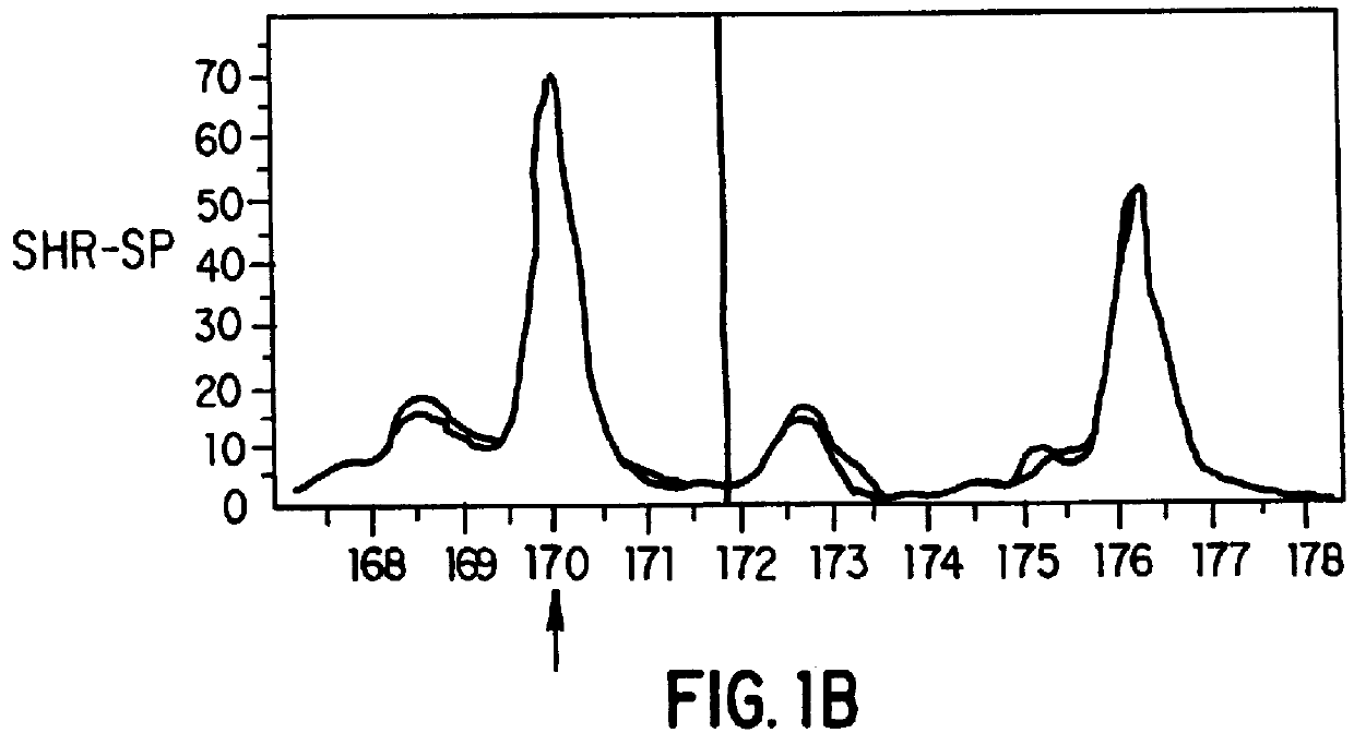 Atrial natriuretic factor mutants and ischemic stroke