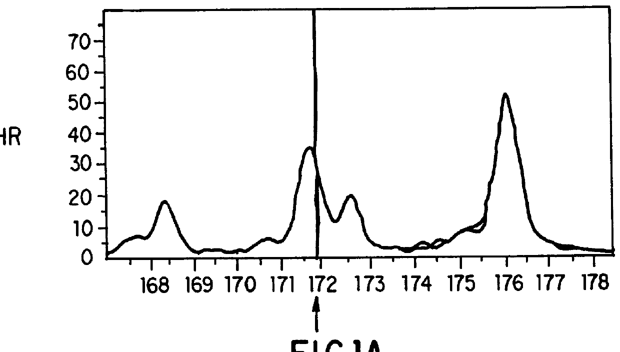 Atrial natriuretic factor mutants and ischemic stroke