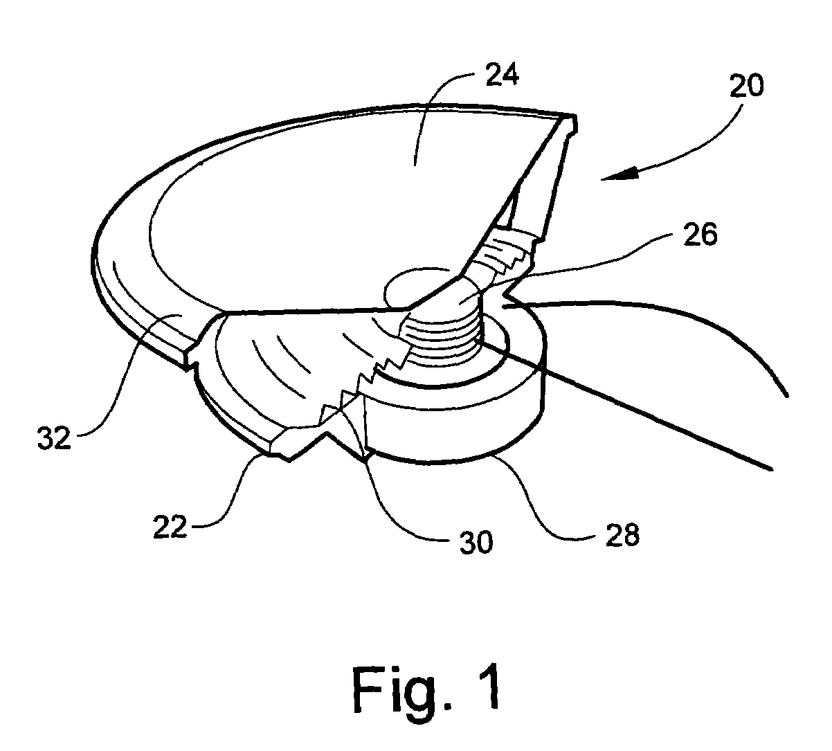 Tangential stress reduction system in a loudspeaker suspension