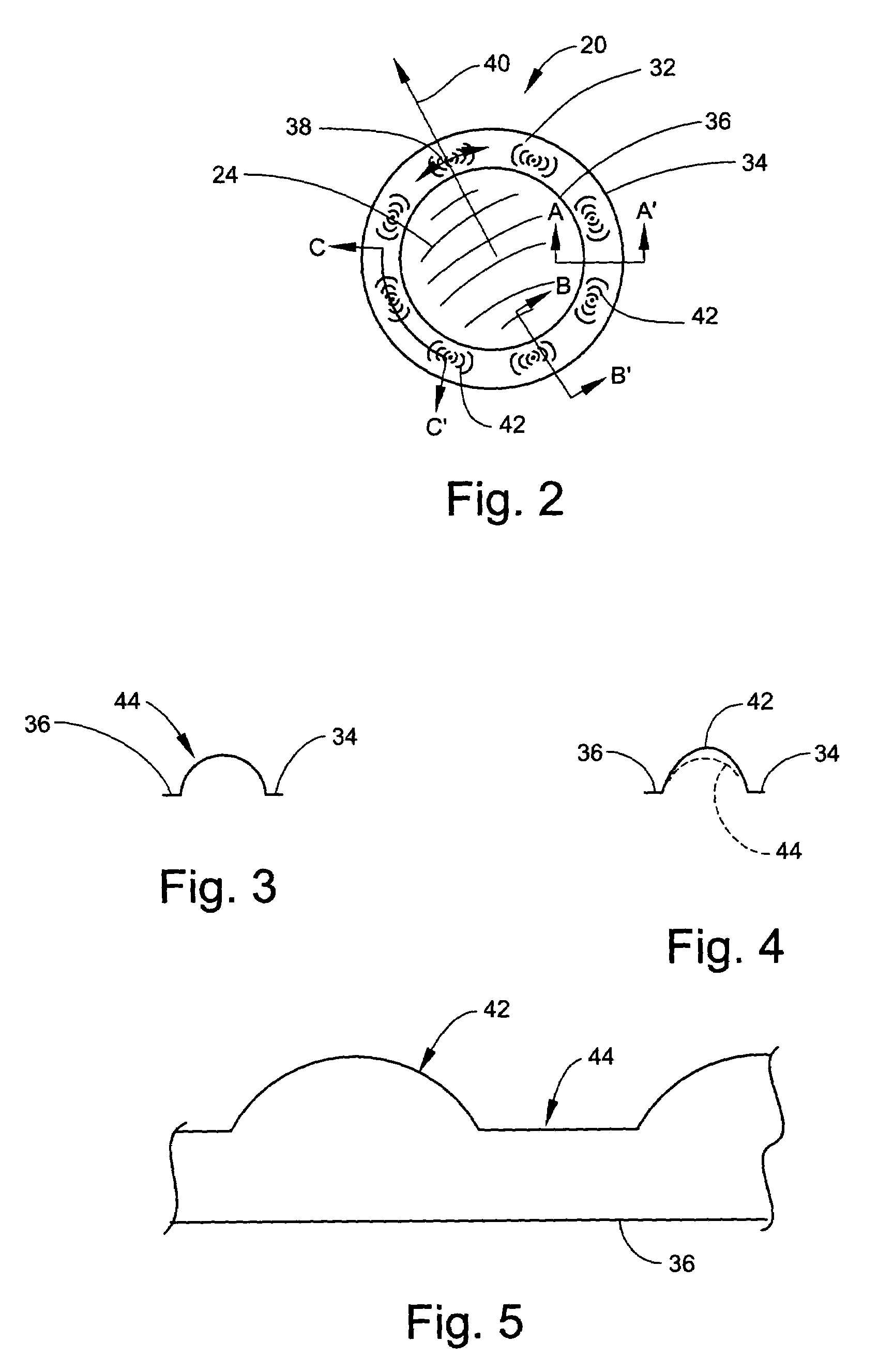 Tangential stress reduction system in a loudspeaker suspension