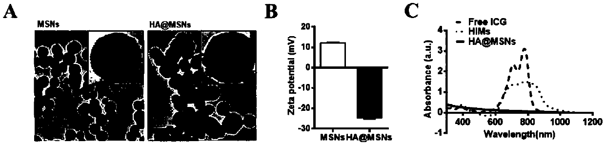 Intelligent macrophage tumor targeting therapy system and preparation method and application thereof