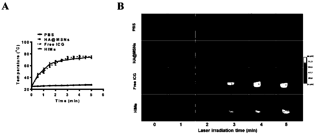 Intelligent macrophage tumor targeting therapy system and preparation method and application thereof