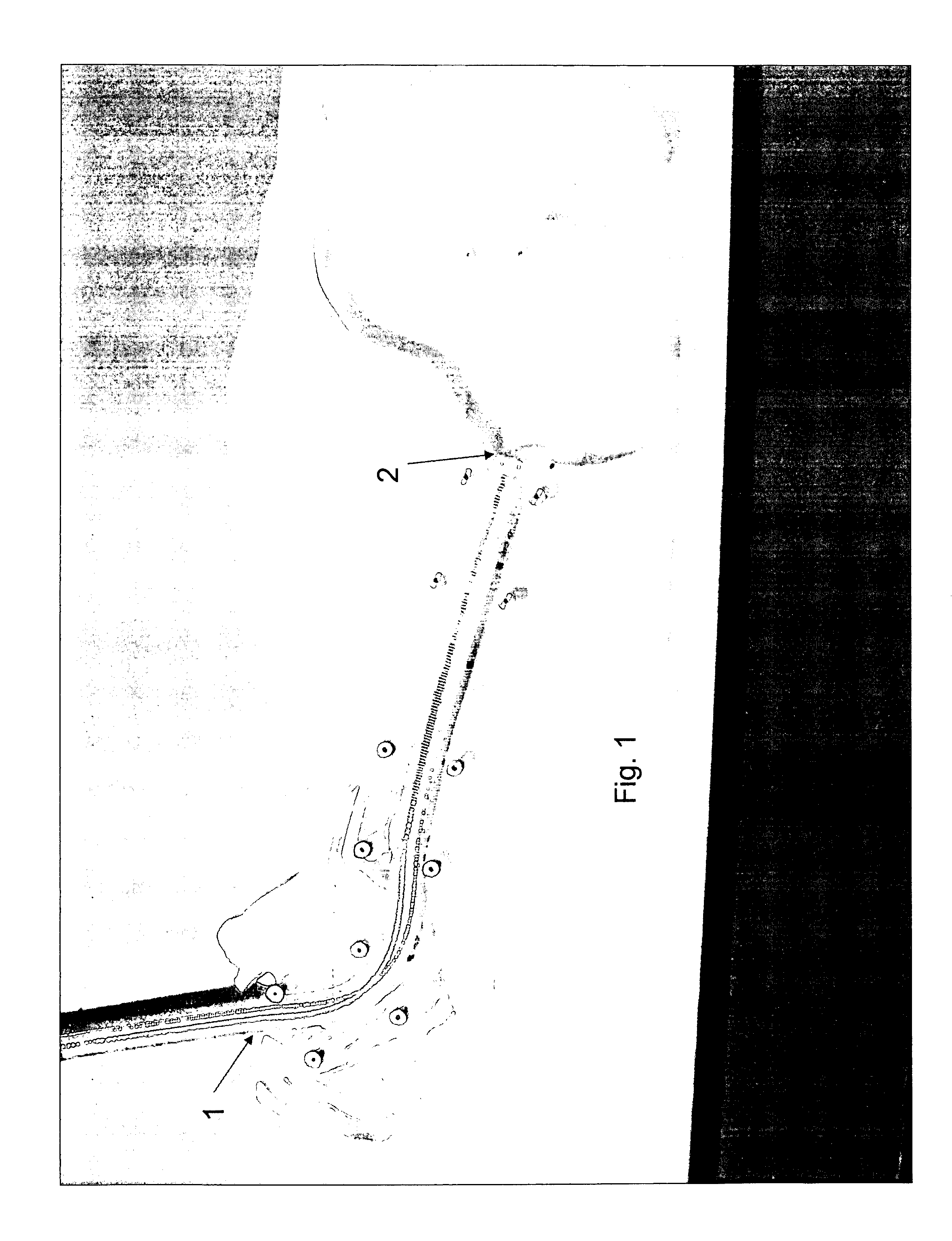 Method for inducting weight loss using a coil for insertion into a hollow body organ