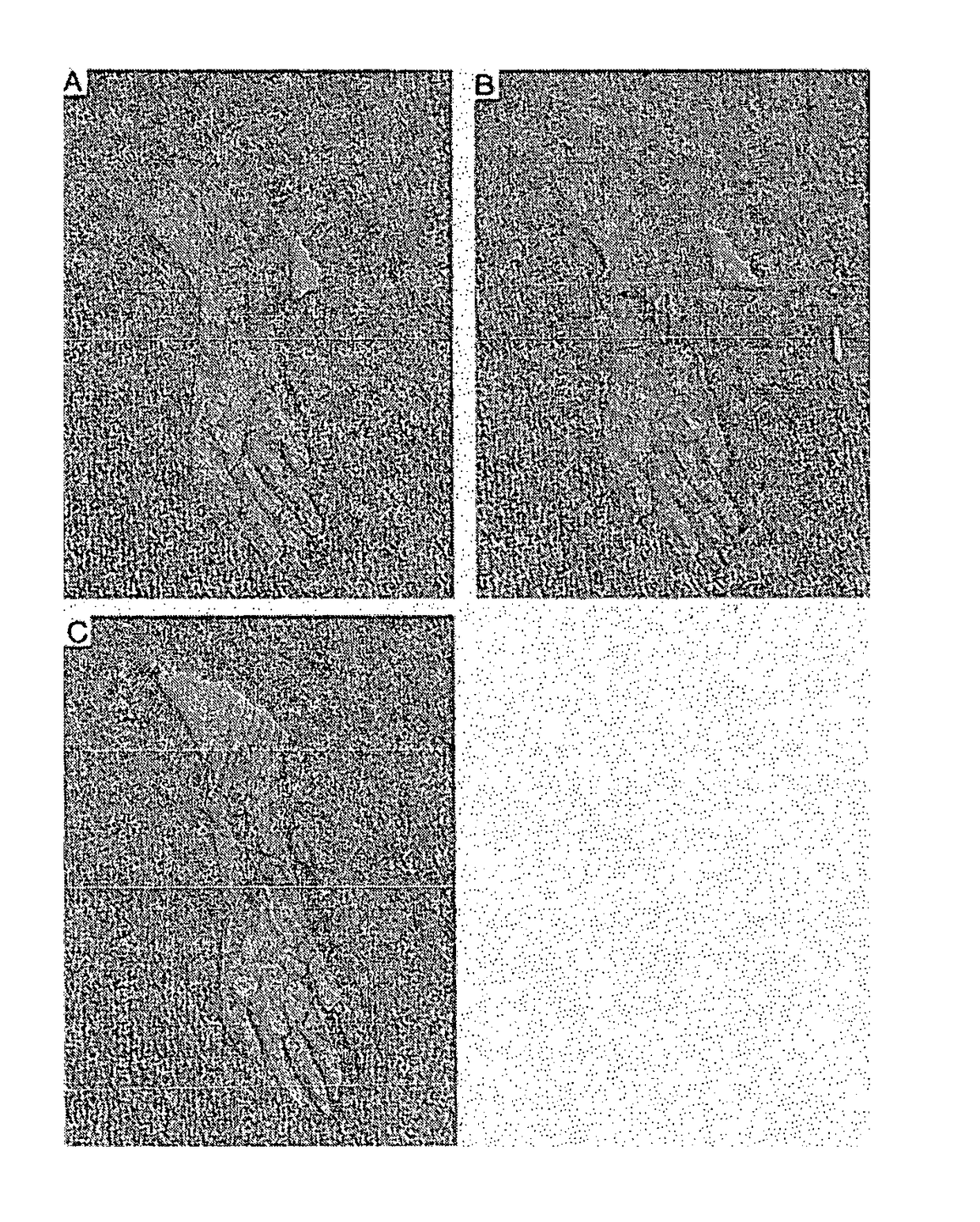 Sulfamate derivative compounds for use in treating or alleviating pain