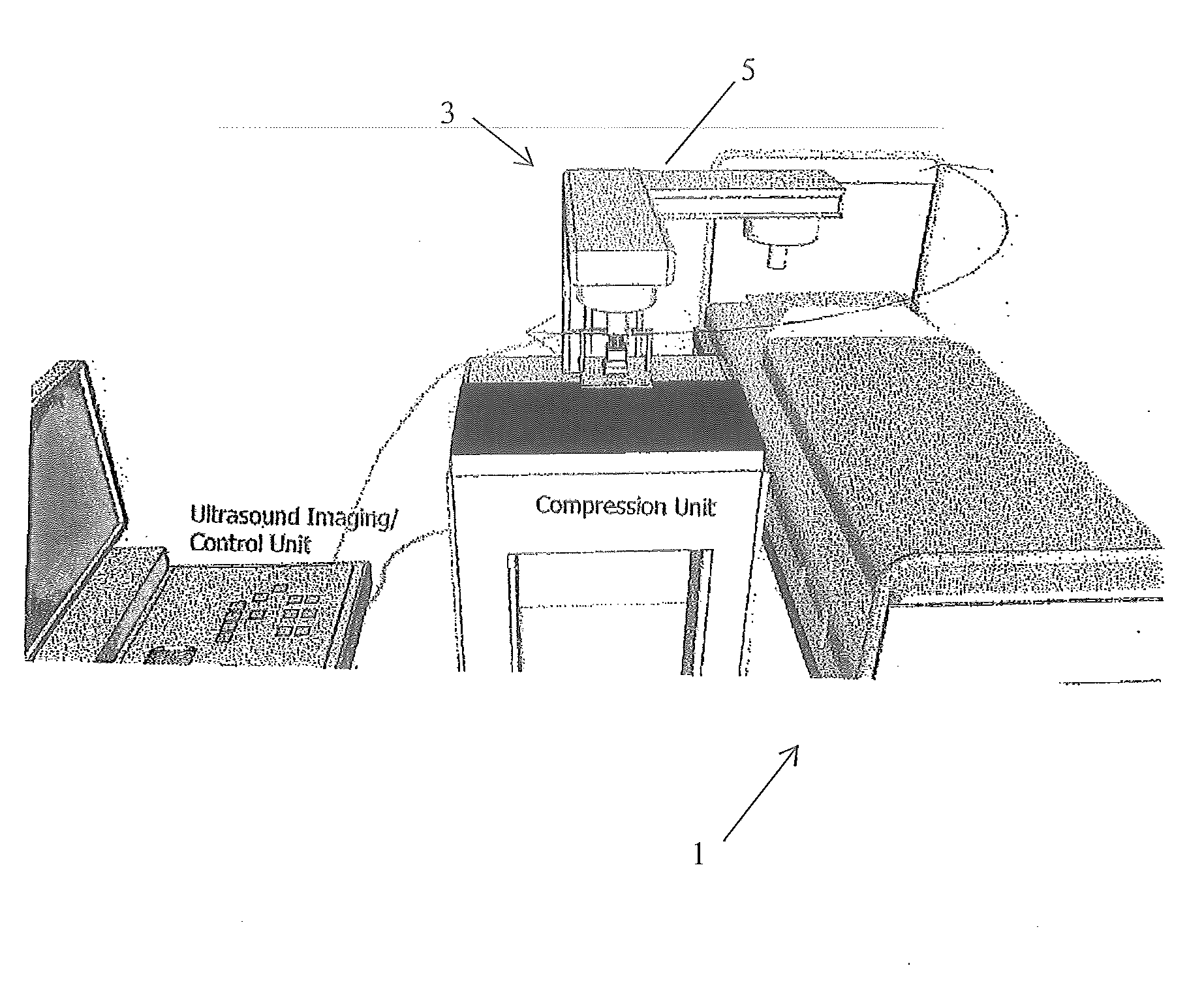 System and Device for Tumor Characterization Using Nonlinear Elastography Imaging