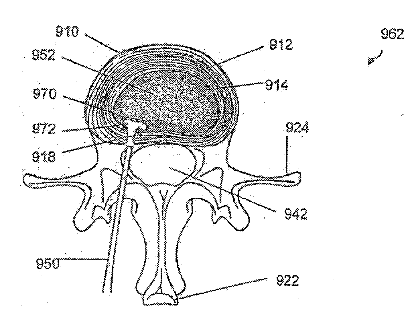 Systems and methods for controlling and forming polymer gels